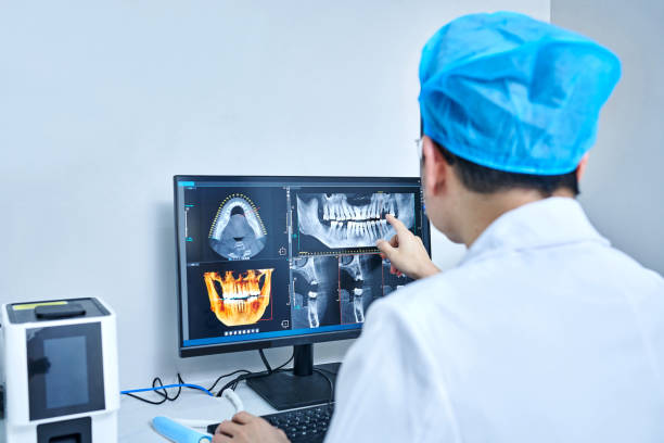 Best Emergency Tooth Extraction in Teviston, CA